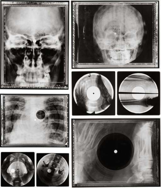 József Hajdú, X-ray Records, fotografie, 1998